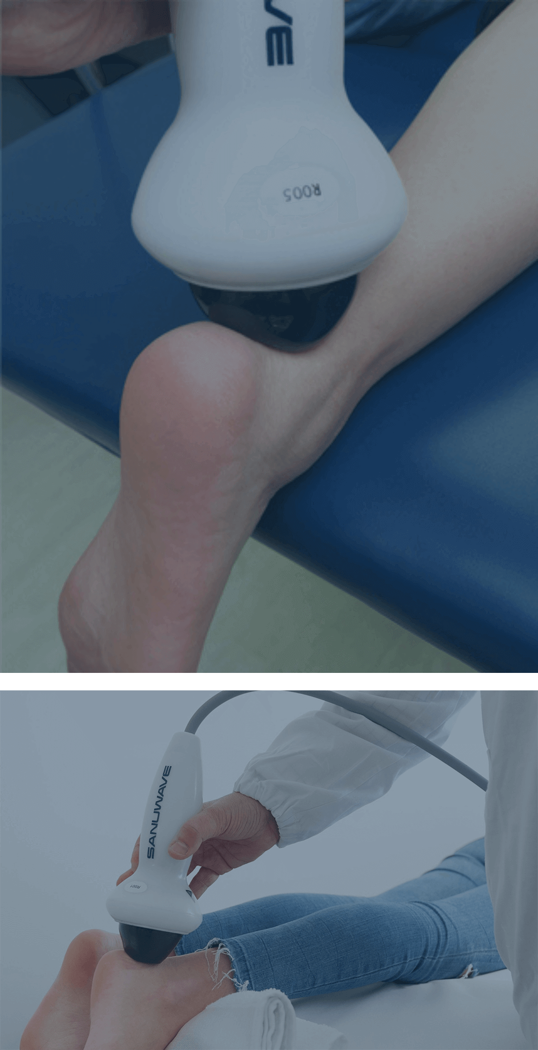 Terapia onde d’urto focali